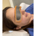 Positioning Aid for eye lens protection